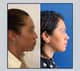Slider image (10) Dr. Jose E. Telich - Plastic Surgeon